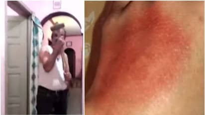 കെജിഎഫ് സിനിമയിലെ ഡയലോഗ് പറഞ്ഞ് 10 വയസുകാരിയെ ചുറ്റിക കൊണ്ട് അടിച്ചു; അച്ഛന്‍ അറസ്റ്റില്‍