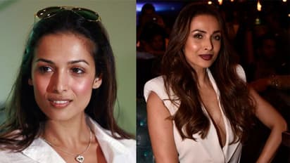 काले रंग के कारण खूब उड़ा मजाक, मलाइका अरोड़ा ने किया खुलासा, बोली- इंडस्ट्री ने किया भेदभाव