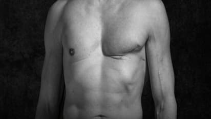 पुरुषों को भी हो रही ब्रेस्ट कैंसर की बीमारी, रहें अलर्ट