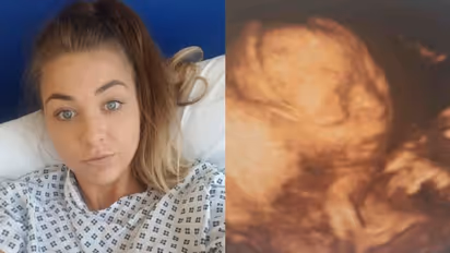 ആറ് തവണ ഗര്ഭം അലസി, രണ്ട് ഗര്ഭപാത്രവും യോനിയുമുണ്ടെന്ന് ആദ്യം കരുതി; ഒടുവില് ഡോക്ടര്മാര് കണ്ടെത്തിയത്...