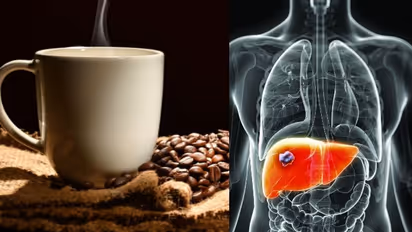 കരള് ക്യാന്സറും കോഫി കുടിയും; പുതിയ പഠനം പറയുന്നത് ഇങ്ങനെ...