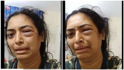 என் புருஷன் அடிச்சு கொல்றான் காப்பாத்துங்க... ரத்தத்துடன் வீடியோ வெளியிட்டு பதற வைக்கும் இளம்பெண்..!