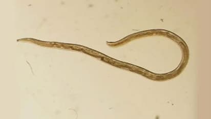 ചൊറിച്ചിലും അസ്വസ്ഥതയും; കണ്ണ് തിരുമ്മിയപ്പോള്‍ കിട്ടിയത്...