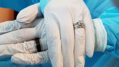 ആശുപത്രിയിലെ അത്യാഹിത വിഭാഗത്തിൽ കല്ല്യാണം, ഗ്ലൗസ്സിട്ട് മോതിരം മാറി ദമ്പതികൾ; പിന്നിലെ കഥയിതാണ്!