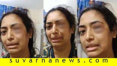 ಶಾರ್ಜಾದಲ್ಲಿ ಬೆಂಗಳೂರು ಮಹಿಳೆ ಮೇಲೆ ಹಲ್ಲೆ: ಪತಿ ಬಂಧನ