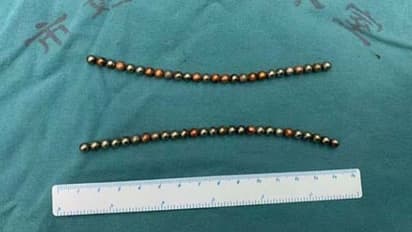 ലിംഗത്തിനകത്തേക്ക് കാന്തം കയറ്റി; മരണം കണ്ടുമടങ്ങി പതിനാലുകാരന്‍