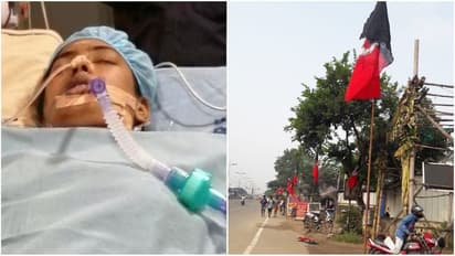 காவு வாங்கிய விளம்பர வெறி..! அதிமுக கொடிக்கம்பம் சாய்ந்த விபத்தில் இளம்பெண்ணின் கால் அகற்றம்..!