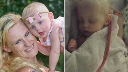 ദിവസവും ആറ് ബോട്ടിൽ പശുവിൻ പാൽ നൽകി; പെട്ടന്നൊരു ദിവസം രണ്ട് വയസുകാരിയ്ക്ക് സംഭവിച്ചത്...