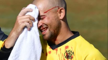 ஆஸ்திரேலிய வீரருக்கு பந்து நெற்றிப்பொட்டில் அடித்து பொள பொளனு கொட்டிய ரத்தம்.. பார்ப்போரை பதறவைக்கும் வீடியோ