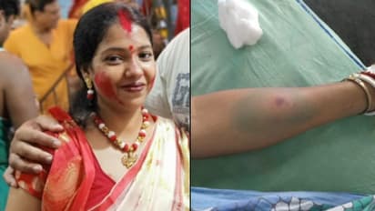 অজানা পোকার কামড়ে সবুজ দেহ, হুগলিতে গৃহবধূর মৃত্যু ঘিরে আতঙ্ক