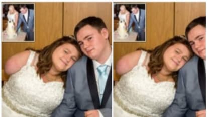 புற்றுநோயால் 2 கைகளை இழந்த காதலி..! கைவிடாத காதலன்..."அவள் தான் என் மனைவி".. வைரலாகும் திருமண புகைப்படம்...!