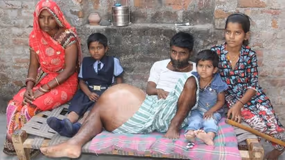 क्या मेरे पापा मर जाएंगे..., लाचार पिता के मासूम बच्चे डरते हुए इस पूछते हैं ऐसे सवाल