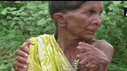 20 కాలి వేళ్లు.. 12 చేతి వేళ్లు... చేతబడి చేస్తోందంటూ...