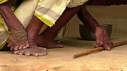 হাতে ১২টি আঙুল, পায়ে ২০টি, একলাই দিন কাটে গঞ্জমের 'ডাইনি বুড়ি'র