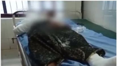 റാഗിങ്ങിനിടെ ക്രൂരമർദനം; മലപ്പുറത്ത് മൂന്ന് പ്ലസ് വണ് വിദ്യാര്ത്ഥികളുടെ കൈയൊടിഞ്ഞു