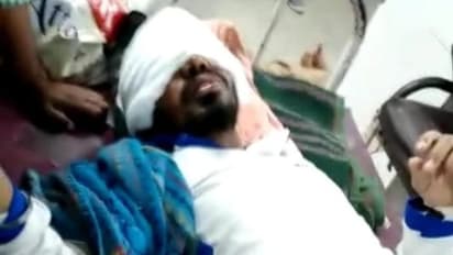 പ്രണയം നിരസിച്ചു; യുവാവിന്റെ മുഖത്ത് ആഡിഡ് ഒഴിച്ച് യുവതി