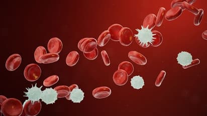 ബ്ലഡ് ക്യാന്സര്; പ്രധാനപ്പെട്ട ലക്ഷണങ്ങൾ