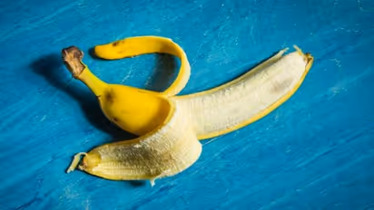 এবার স্বাস্থ্যের উন্নতি ঘটবে কলার খোসায়, একাধিক রোগ থেকে বাঁচতে কলার খোসা খান