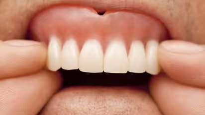 കേക്ക് കഴിക്കുന്നതിനിടെ വെപ്പ് പല്ല് കാണാതായി; എണ്‍പതുകാരന് സംഭവിച്ചത്...