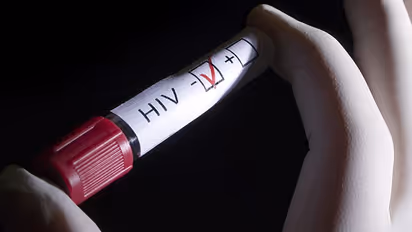 ചുംബനത്തിലൂടെ എയ്ഡ്സ് പകരുമോ..?