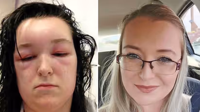 ഭംഗിക്ക് വേണ്ടി 'ഡൈ' അടിച്ചു; ജീവന് പോയില്ലെന്ന് മാത്രം...