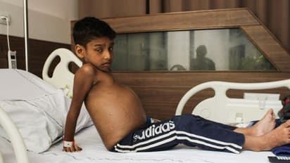 बच्चे का फूला हुआ पेट देख झर-झर बहते हैं मां-बाप के आंसू, जान बचाने को बेचना पड़ेगा घर