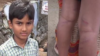 வகுப்பறையில் பேசிய மாணவனை பிரம்பால் வெளுத்த ஆசிரியர்..! ரத்த தழும்புகளுடன் மருத்துவமனையில் அனுமதி..!