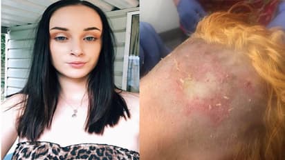 काले बालों को सुनहरा करना चाहती थी लड़की, फैशन के चक्कर में हुआ खौफनाक हाल