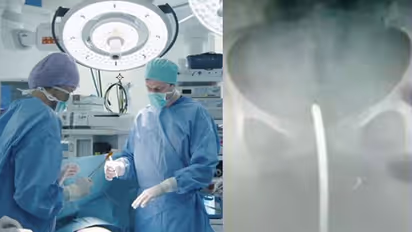 പ്രസവം കഴിഞ്ഞപ്പോൾ അമിത രക്തസ്രാവവും ശക്തമായ വയറ് വേദനയും അനുഭവപ്പെട്ടു ; എക്‌സ് റേ പരിശോധനാ ഫലം കണ്ടപ്പോൾ ഡോക്ടർമാർ ഞെട്ടി