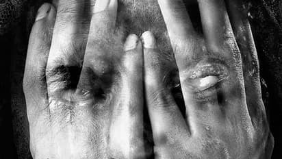 உத்தரபிரதேசத்தில் அடுத்தடுத்து பயங்கரம்... பலாத்கார வழக்கை வாபஸ் பெற மறுத்த பெண் மீது ஆசிட் வீச்சு..!