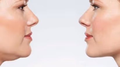 മുഖത്ത് കൊഴുപ്പ് അടിഞ്ഞുകൂടുന്നുവോ? ഒഴിവാക്കാനിതാ അഞ്ച് മാര്ഗങ്ങള്...