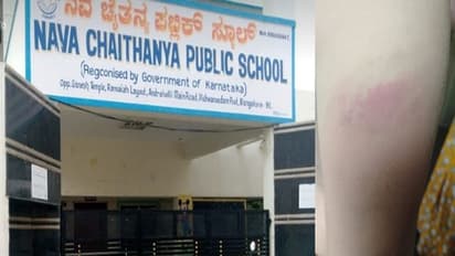 ಬೆಂಗಳೂರು: ವೈಯಕ್ತಿಕ ಕಾರಣಕ್ಕೆ 1ನೇ ಕ್ಲಾಸ್ ವಿದ್ಯಾರ್ಥಿನಿ ಥಳಿಸಿದ ಶಿಕ್ಷಕಿ