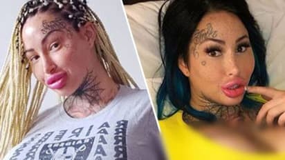 ലോകത്തിലെ ഏറ്റവും വലിയ യോനിയ്ക്കുടമയാകാൻ വേണ്ടി യുവതി സർജറി ചെയ്തു, അവസാനം സംഭവിച്ചത്...