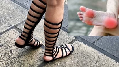 পুজো মানেই পায়ে নতুন জুতো, আর সঙ্গে ফোসকা, এবার আগে থেকেই জেনে নিন সমস্যা এড়ানোর টিপস