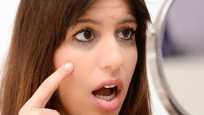 Eye care tips: கண்ணை சுற்றி கருவளையமா? முகத்தை வெளியே காட்ட சங்கடமா..? ஐந்து எளிய டிப்ஸ்…!!