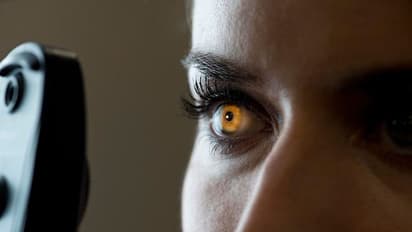 കണ്ണ് പരിശോധനയ്ക്കിടെ യുവതിയെ ചുംബിച്ചു; യുഎഇയില് ഇന്ത്യക്കാരന് ശിക്ഷ