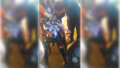 बस के लिए खड़ी थी 20 वर्षीय छात्रा, तभी मुंह ढंककर बाइक से आए दो लड़कों ने फेंक दिया तेजाब