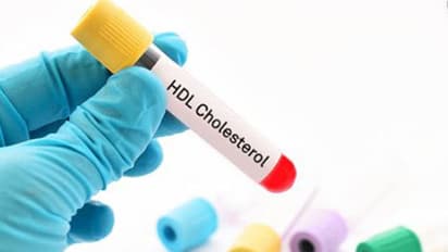 ഈ 5 കാര്യങ്ങൾ ശ്രദ്ധിച്ചാൽ എച്ച്ഡിഎൽ കൊളസ്ട്രോൾ കൂട്ടാം