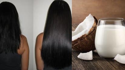 തലമുടി തഴച്ച് വളരാന് തേങ്ങാപ്പാല് മാത്രം മതി; ഉപയോഗിക്കേണ്ട വിധം...