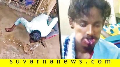 ಮುತ್ತು ಕೊಡಲು ಹೋದವನಿಗೆ ಕಚ್ಚಿ ಹರಿದ ಹಾವು