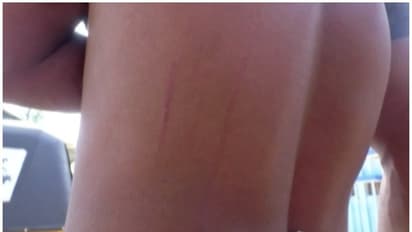 മൊഴി കൊടുത്തതിലെ വൈരാഗ്യം; ചേമ്പളത്ത് മൂന്ന് പേര്ക്കുനേരെ യുവാക്കളുടെ ആക്രമണം