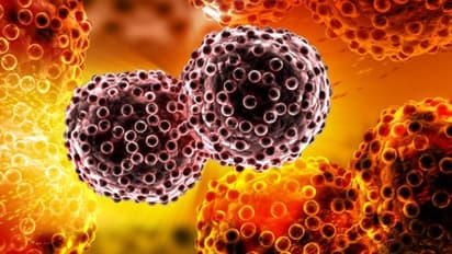 മലാശയ അര്ബുദം; ഈ ലക്ഷണങ്ങള് ശ്രദ്ധിക്കാതെ പോകരുതേ...