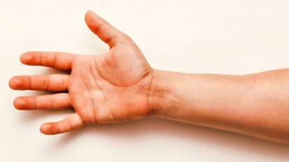 हथेली में यहां होती हैं संतान, विवाह और प्रेम संबंध बताने वाली रेखाएं, जानिए इनसे जुड़ी खास बातें