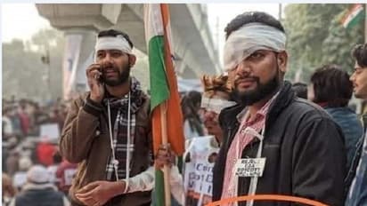 Fact Check: ಗಾಯಗೊಳ್ಳದಿದ್ದರೂ ಬ್ಯಾಂಡೇಜ್ ಸುತ್ತಿಕೊಂಡ್ರಾ CAA ಪ್ರತಿಭಟನಾಕಾರರು?