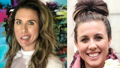 രാവിലെ ഉണര്‍ന്നത് മുഖത്തിന്‍റെ ഒരു വശം  തളര്‍ന്ന അവസ്ഥയില്‍; 29കാരിക്ക് സംഭവിച്ചത്...