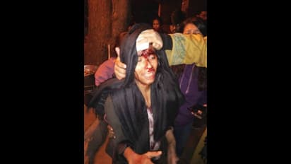 ജെഎൻയു ആക്രമണം: 'ഇന്ന് എന്റെ മകൾ, നാളെ അത് ഞാനാകാം, അല്ലെങ്കിൽ മറ്റൊരാൾ': ഐഷി ഘോഷിന്റെ അച്ഛൻ