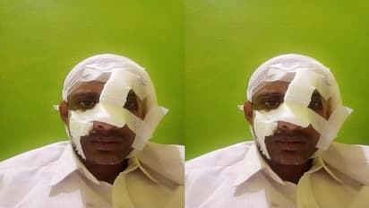 ಬೆಂಗಳೂರು: ಕುಡಿದು ಗಲಾಟೆ ಮಾಡ್ಬೇಡ, ಬುದ್ಧಿ ಹೇಳಿದವರಿಗೆ ಇದೆಂಥಾ ಅವಸ್ಥೆ