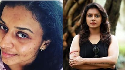 അതിനെ നിങ്ങളെ വേദനിപ്പിക്കാന് അനുവദിക്കാതിരിക്കക; ആത്മവിശ്വാസം പകര്ന്ന് സിത്താരയുടെ കുറിപ്പ്