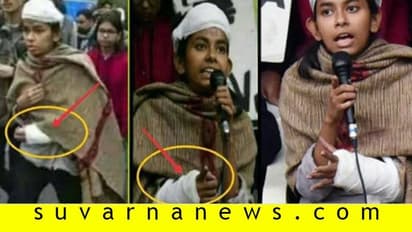 Fact Check| ಆಯಿಷ್ ಘೋಷ್ ಬ್ಯಾಂಡೇಜ್ ಎಡಗೈನಿಂದ ಬಲಗೈಗೆ ಬಂದಿದ್ದು ಹೇಗೆ?