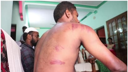 ഇളയ സഹോദരന്റെ വീടാക്രമിക്കാൻ ക്വട്ടേഷൻ; മൂത്ത സഹോദരനെതിരെ കേസ്